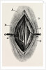 Ligature by Anonymous