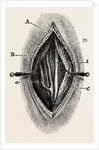 Ligature by Anonymous