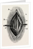 Ligature by Anonymous