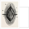 Ligature by Anonymous