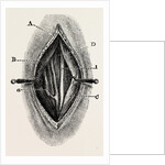 Ligature by Anonymous