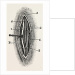 Ligature by Anonymous