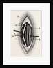 Ligature of the right finger by Anonymous