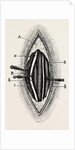 Ligature of the right finger by Anonymous