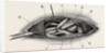 Ligature of the right subclavian ernird part by Anonymous