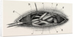 Ligature of the right subclavian ernird part by Anonymous