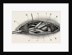 Ligature of the right subclavian ernird part by Anonymous