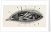 Ligature of the right subclavian ernird part by Anonymous