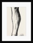 Ligature by Anonymous
