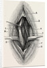 Ligature by Anonymous
