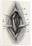 Ligature by Anonymous