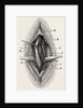 Ligature by Anonymous