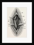 Ligature by Anonymous