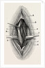 Ligature by Anonymous