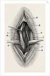 Ligature by Anonymous