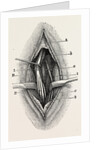 Ligature by Anonymous