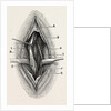 Ligature by Anonymous