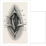 Ligature by Anonymous