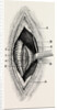 Ligature by Anonymous