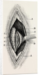 Ligature by Anonymous