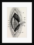 Ligature by Anonymous