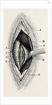 Ligature by Anonymous