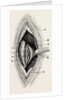 Ligature by Anonymous