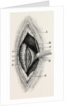 Ligature by Anonymous