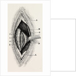 Ligature by Anonymous