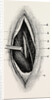 Ligature of by Anonymous