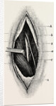 Ligature of by Anonymous