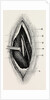 Ligature of by Anonymous