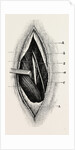 Ligature of by Anonymous