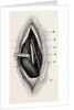 Ligature of by Anonymous