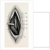 Ligature of by Anonymous