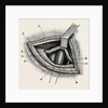 Ligature of right external iliac artery by Anonymous