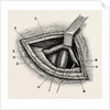 Ligature of right external iliac artery by Anonymous
