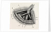 Ligature of right external iliac artery by Anonymous