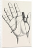 Disartieulation of the thumb by Anonymous