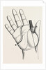 Disartieulation of the thumb by Anonymous
