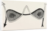 The 66 incision by Anonymous