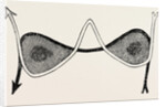 The 66 incision by Anonymous