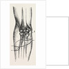 Disarticulation by Anonymous