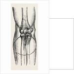 Disarticulation by Anonymous