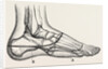 Disarticulation of the little toe by Anonymous
