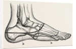Disarticulation of the little toe by Anonymous