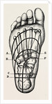 Plantar incisions by Anonymous