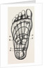Plantar incisions by Anonymous