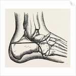 Pasquier by Anonymous