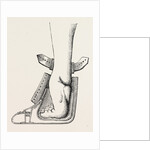 Aspect of limb by Anonymous